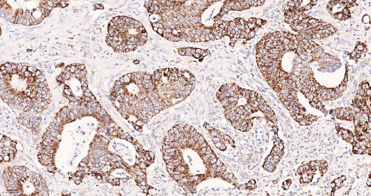 谷氨酰胺酶重组兔单抗
