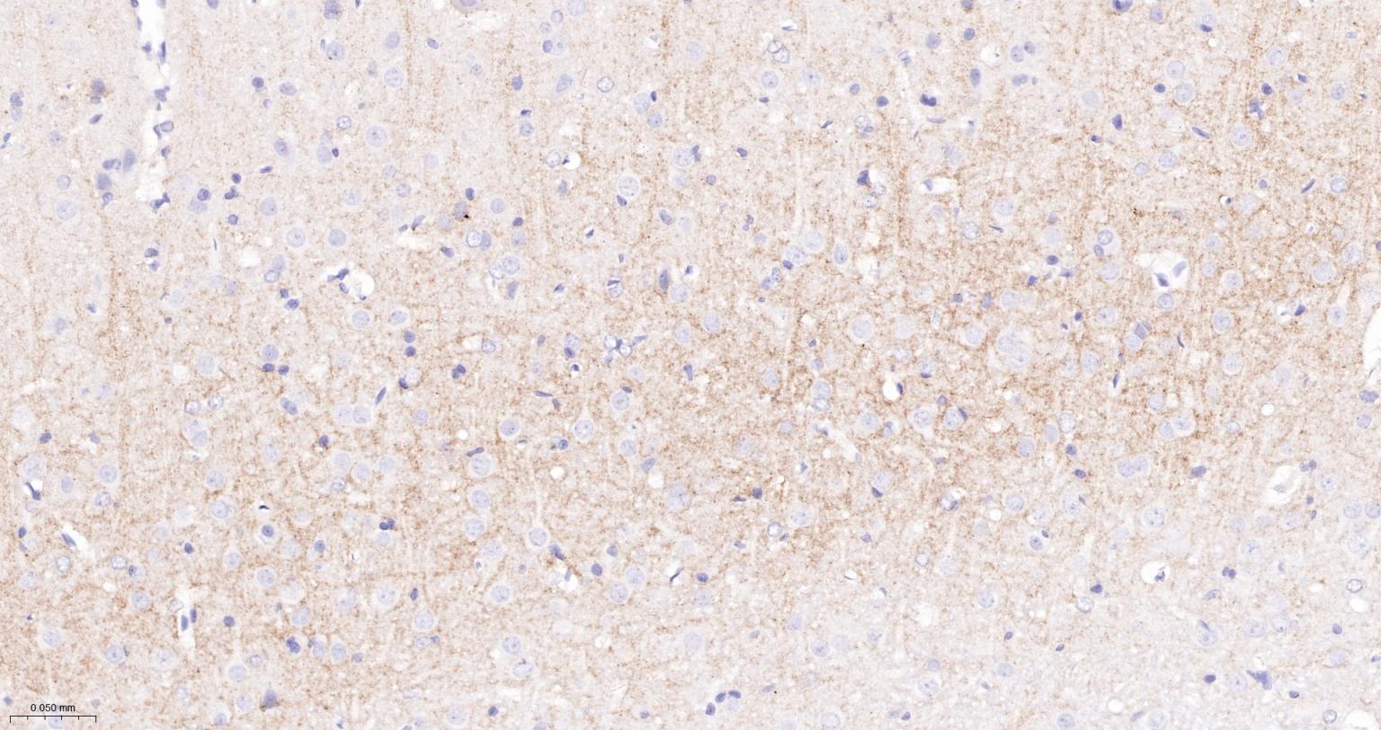 CD15/SSEA1重组兔单抗