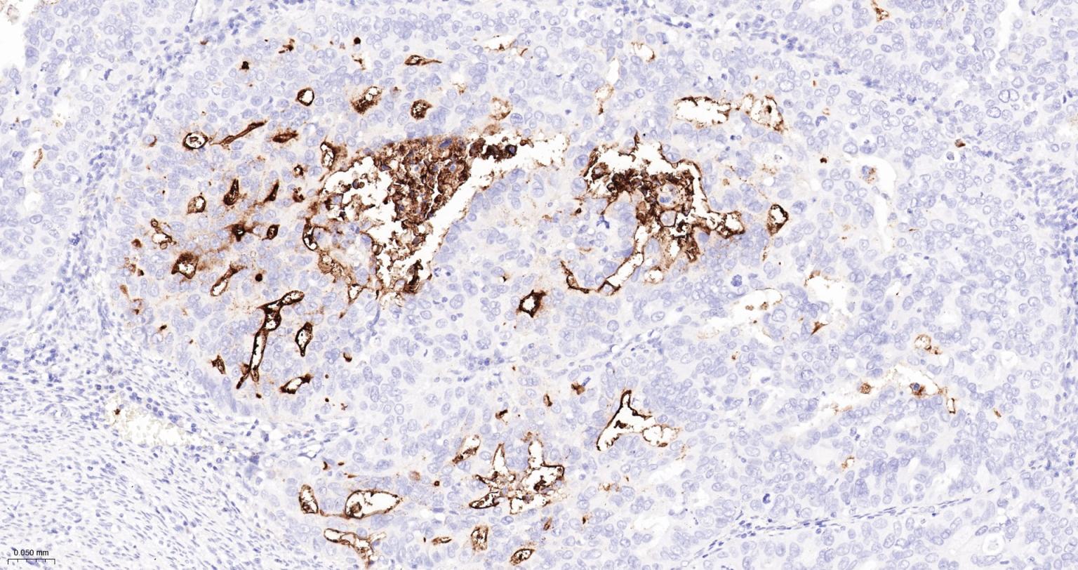 CD15/SSEA1重组兔单抗