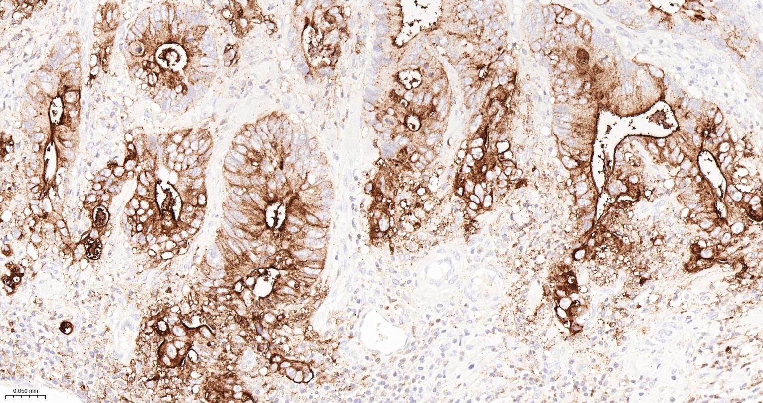 CD15/SSEA1重组兔单抗