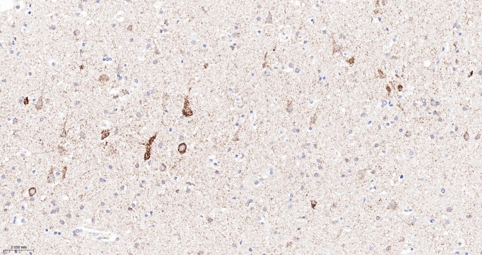 谷氨酰胺酶重组兔单抗