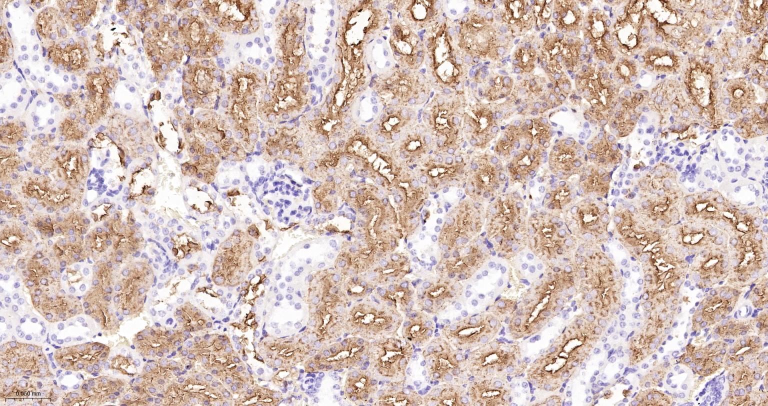 CD15/SSEA1重组兔单抗