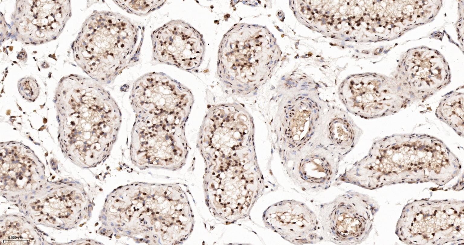 异质核糖核蛋白Q重组兔单抗