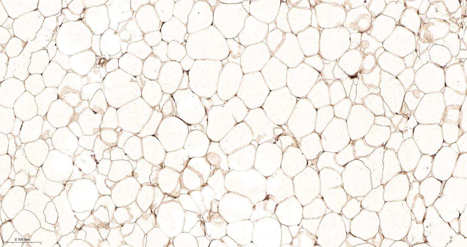 锌α2糖蛋白重组兔单抗