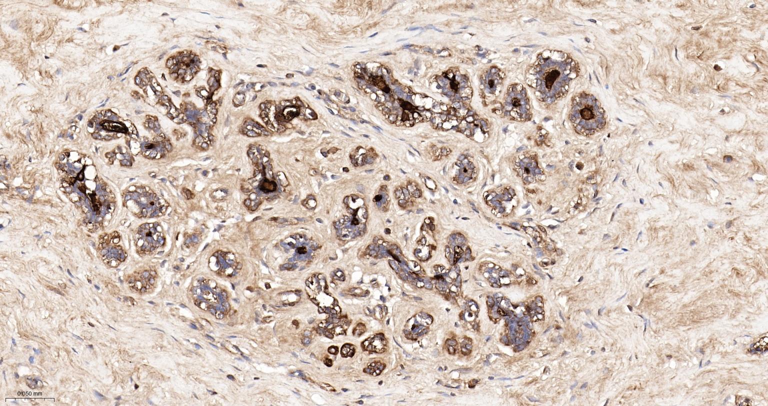 锌α2糖蛋白重组兔单抗
