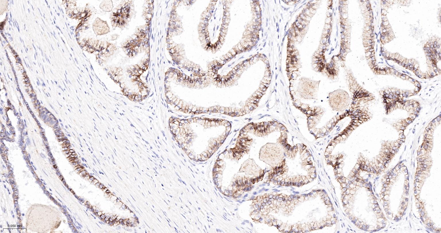 连环蛋白delta-1重组兔单抗