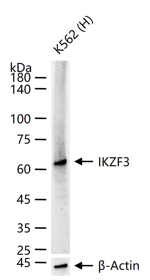 IKZF3 Recombinant Rabbit mAb (一抗) - WB,IHC-P,IHC-F,IF,Flow-Cyt,ICC/IF | Bioss