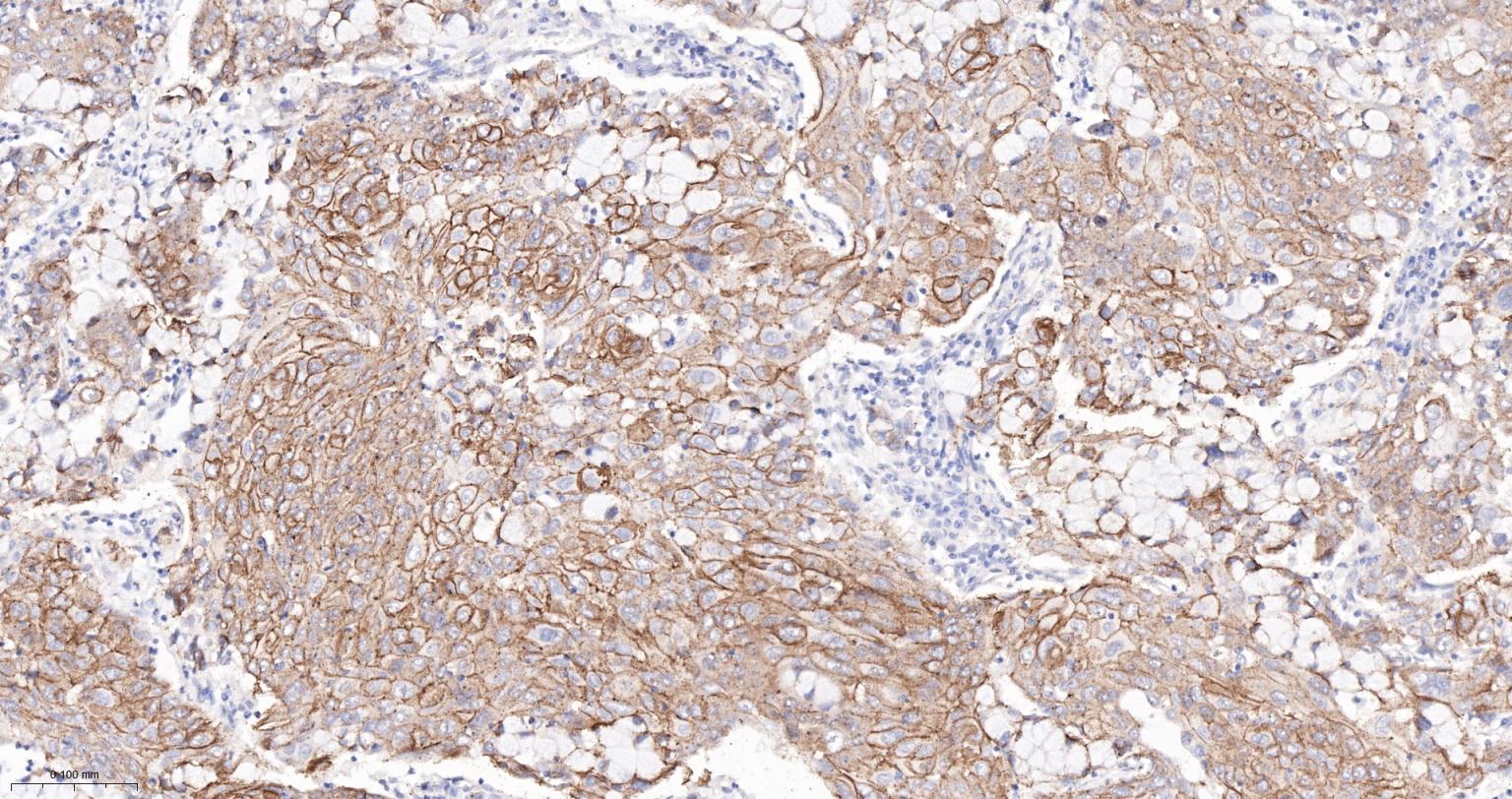 连环蛋白delta-1重组兔单抗