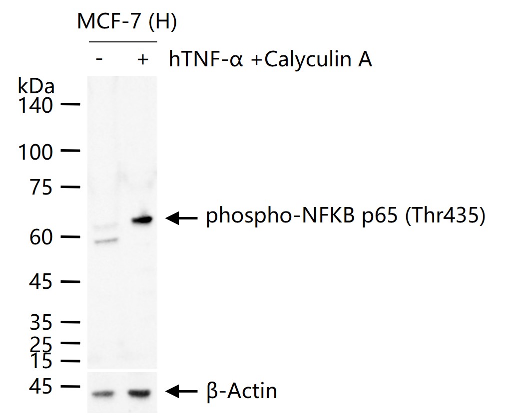 phospho-NFKB p65 (Thr435) Rabbit pAb (一抗) - WB,Flow-Cyt,ICC/IF | Bioss