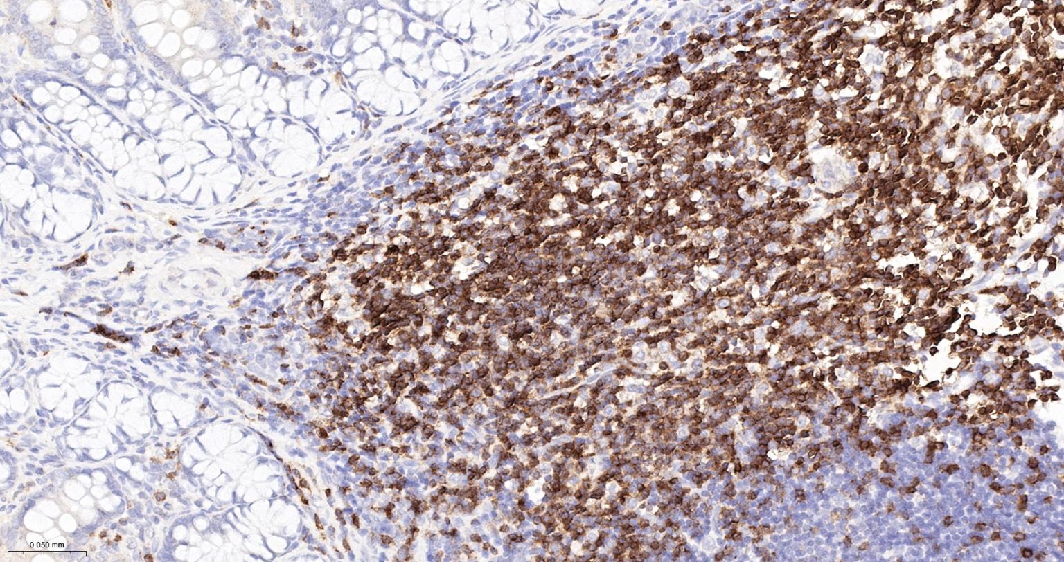 CD3/CD3-ε重组兔单抗