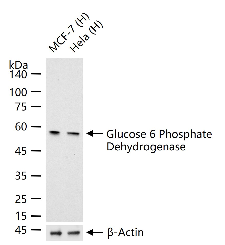 葡萄糖-6磷酸脱氢酶重组兔单抗