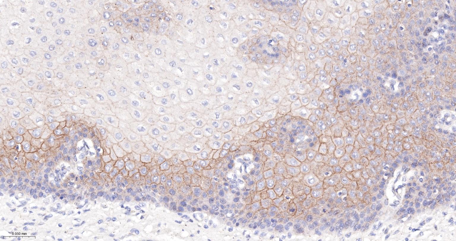 连环蛋白delta-1重组兔单抗