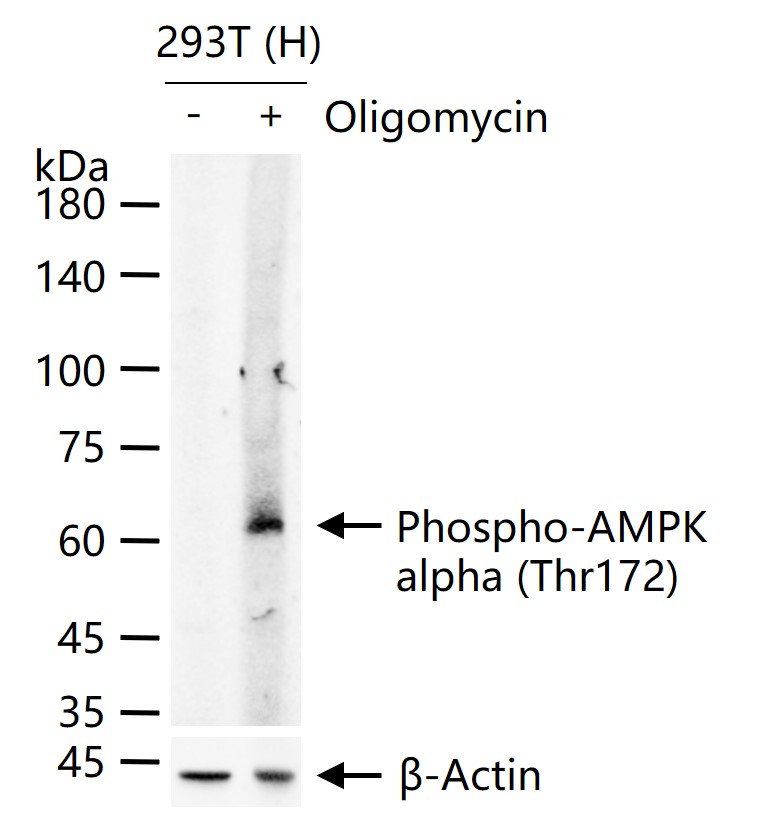 phospho-AMPK alpha (Thr172) Recombinant Rabbit mAb (一抗) - WB | Bioss