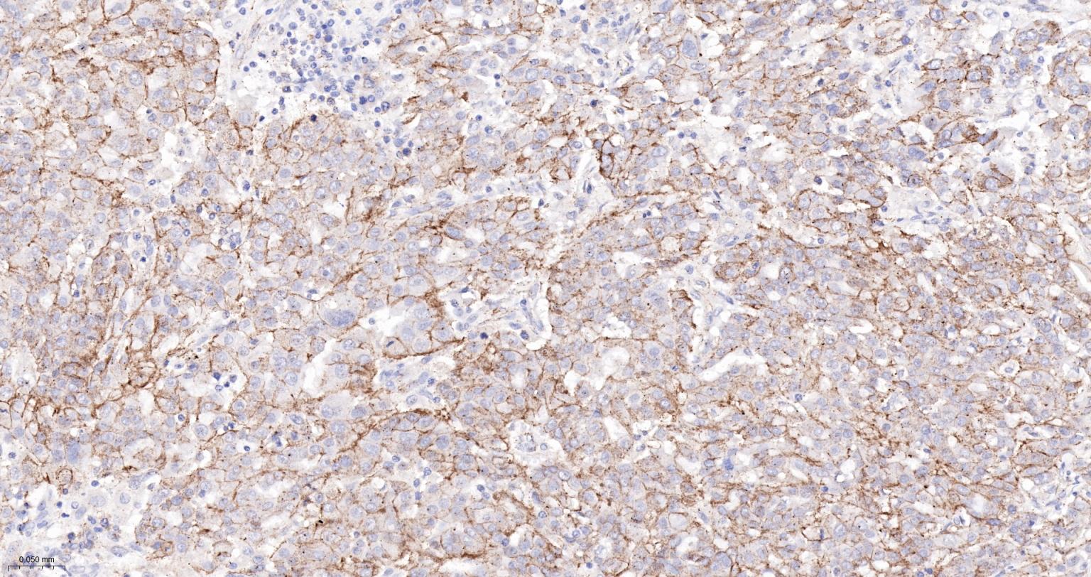 连环蛋白delta-1重组兔单抗