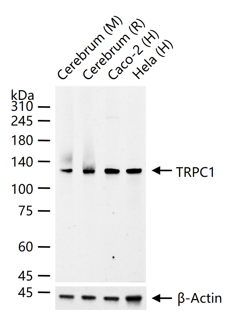 TRPC1 Recombinant Rabbit mAb (一抗) - WB | Bioss