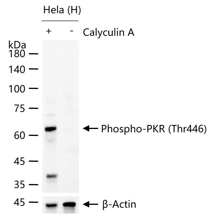 磷酸化干扰素诱导的双链RNA活化蛋白激酶重组兔单抗