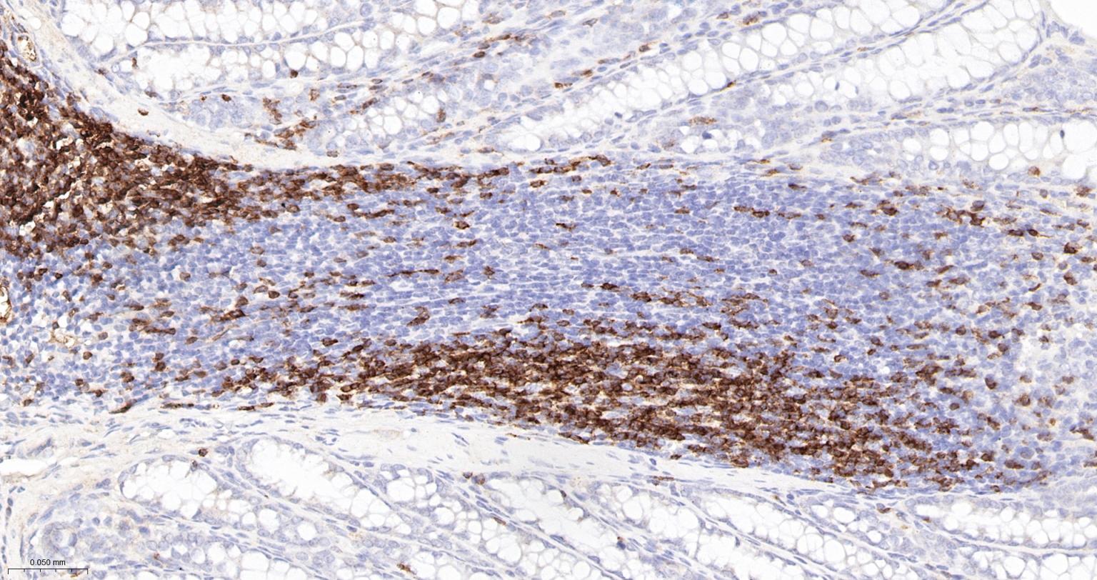 CD3/CD3-ε重组兔单抗