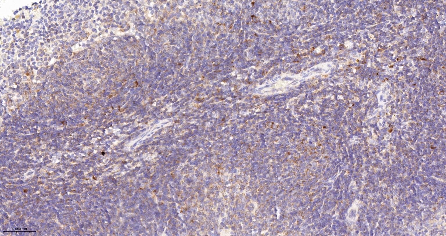 B淋巴细胞连接蛋白重组兔单抗