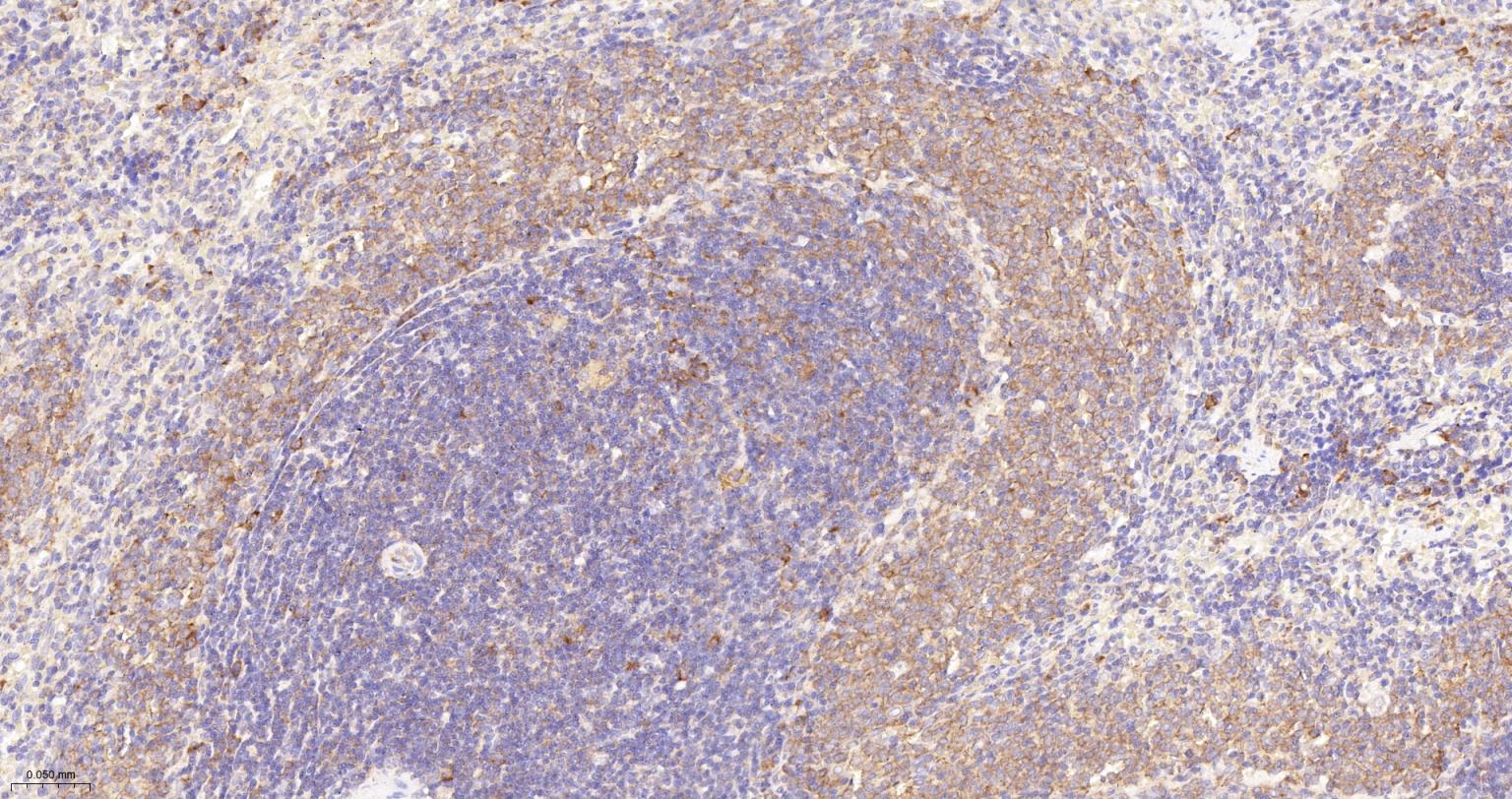 B淋巴细胞连接蛋白重组兔单抗