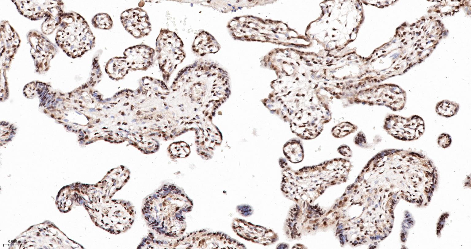 缺氧诱导因子1α抑制蛋白/HIF1AN重组兔单抗
