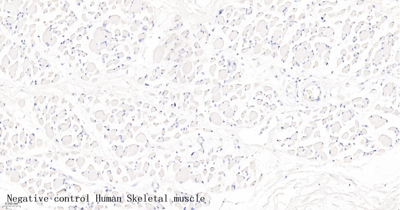 肾小球裂孔膜蛋白PDCN重组兔单抗