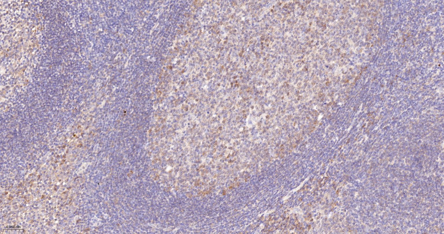 B淋巴细胞连接蛋白重组兔单抗