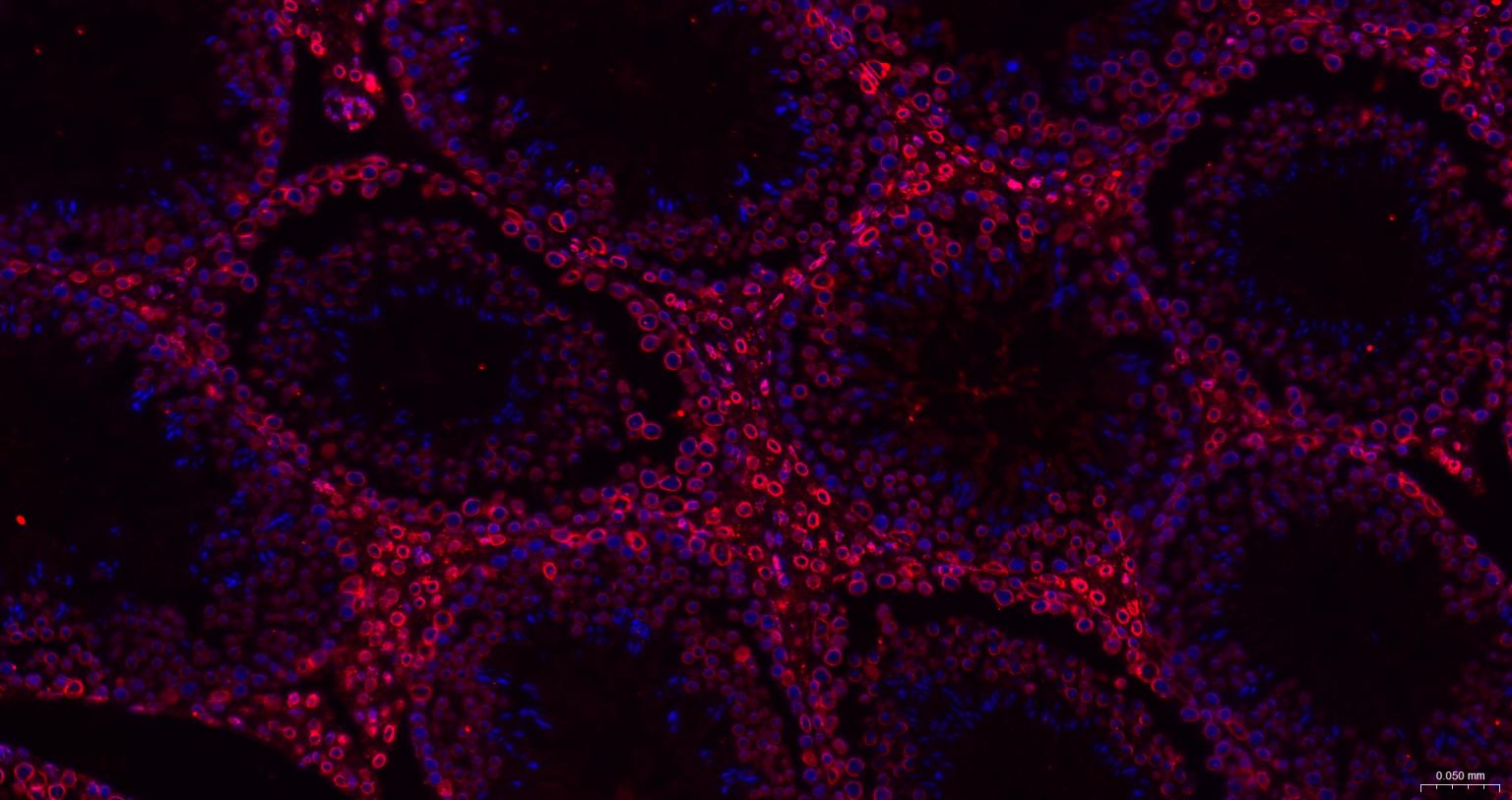 核纤层蛋白B重组兔单抗