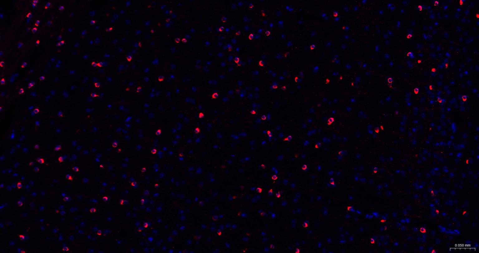 离子型谷氨酸受体1重组兔单抗