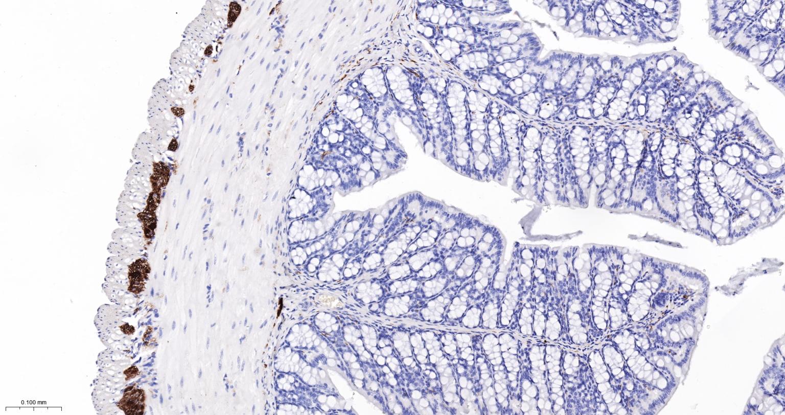 神经细胞胞浆蛋白9.5重组兔单抗