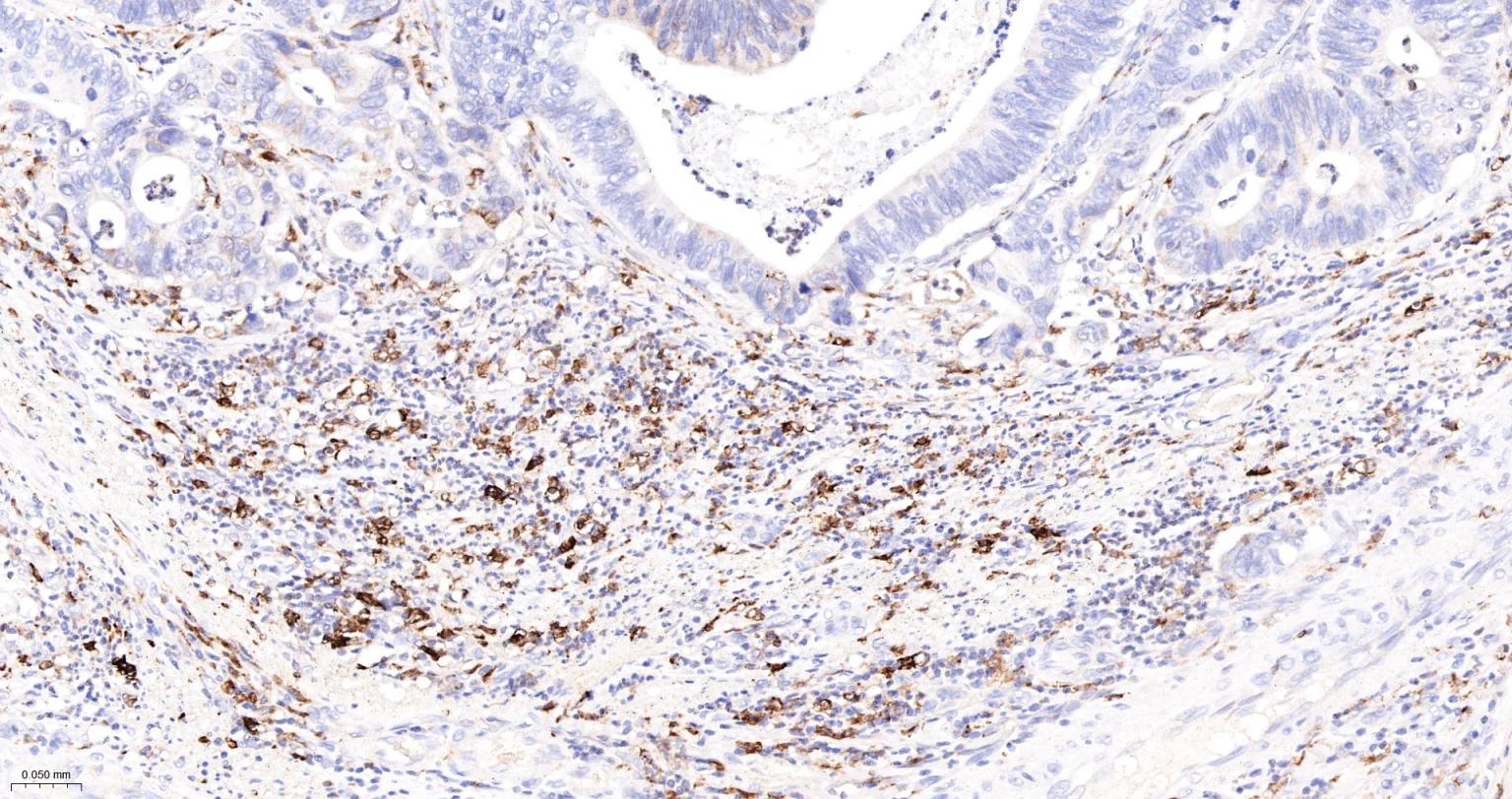 血红素氧合酶 1抗体