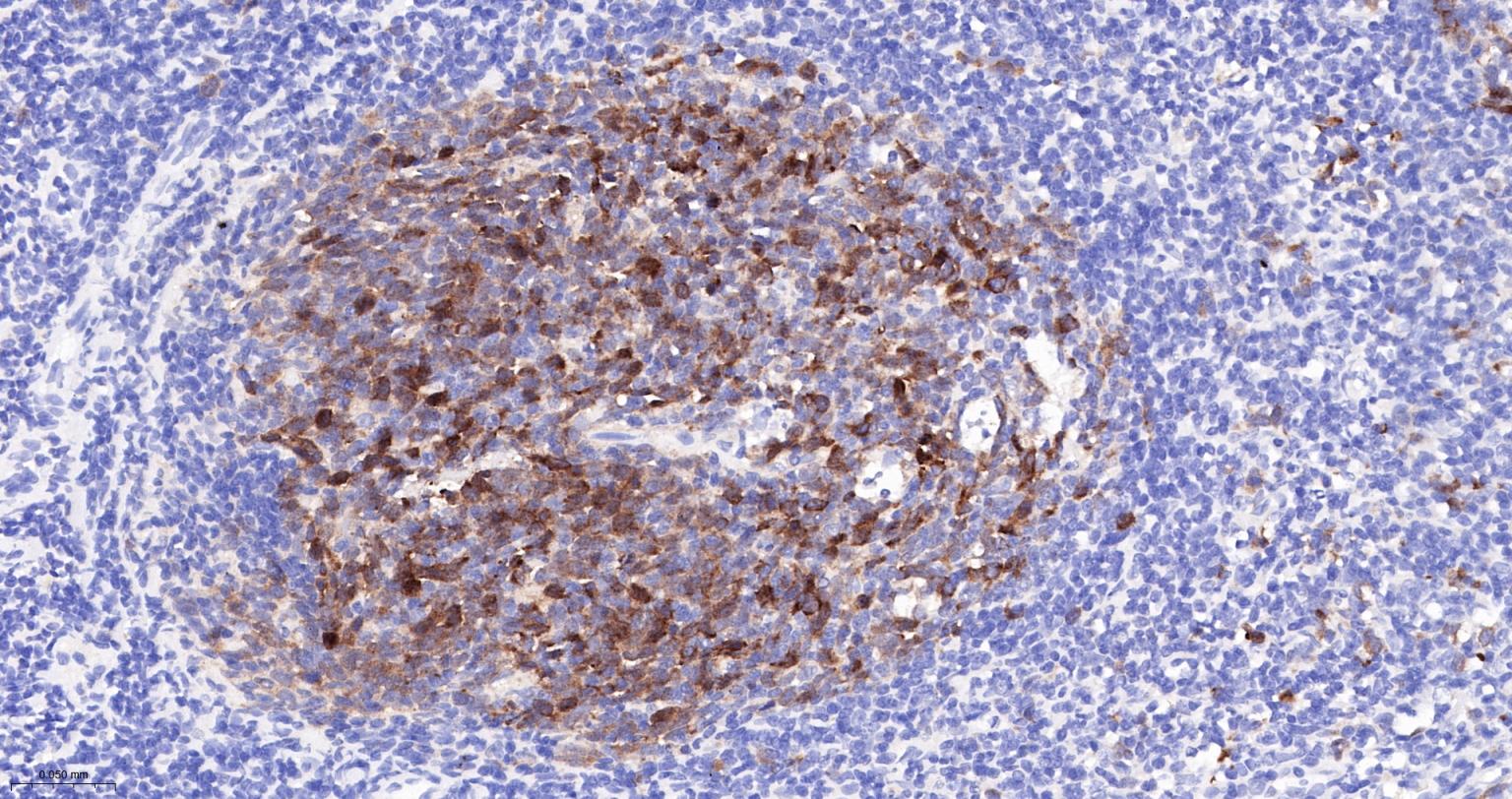 TACC3重组兔单抗