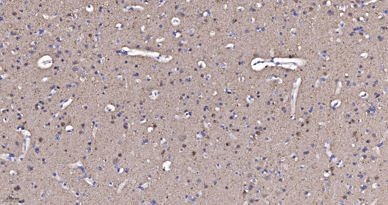 神经细胞胞浆蛋白9.5重组兔单抗