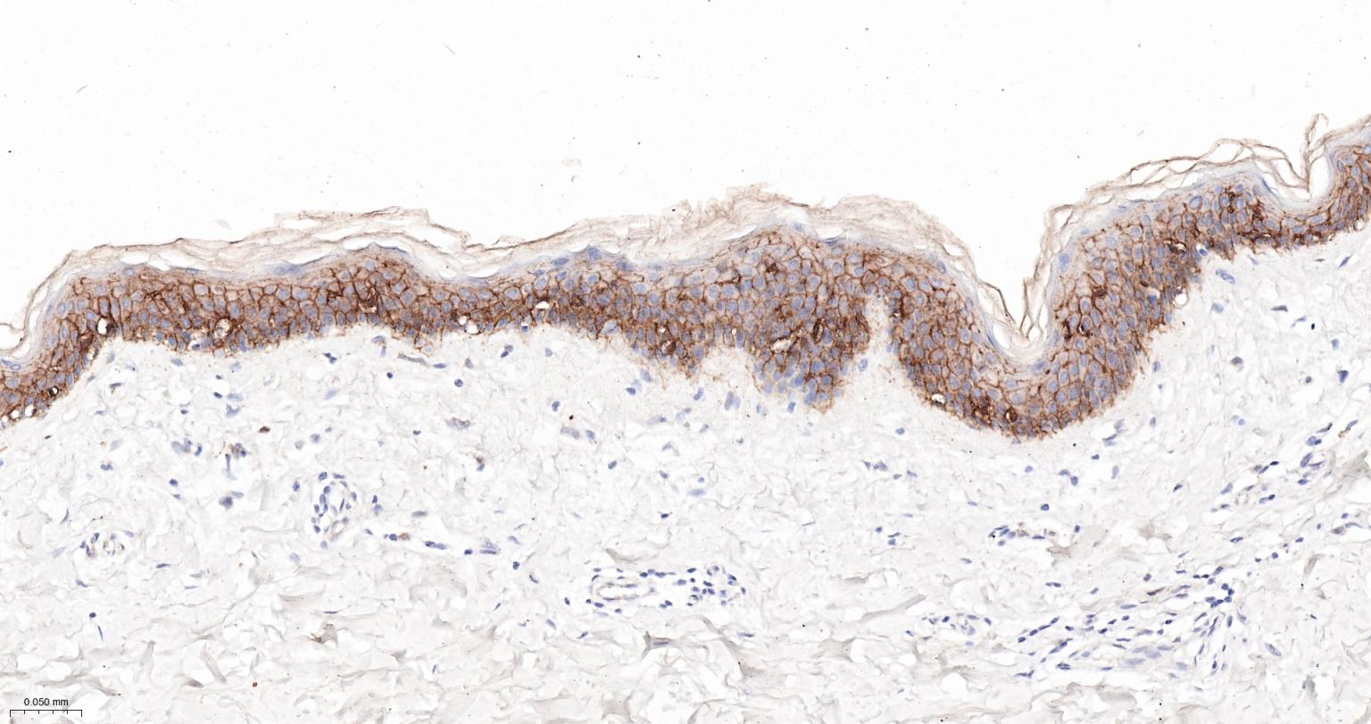 连环蛋白delta-1重组兔单抗