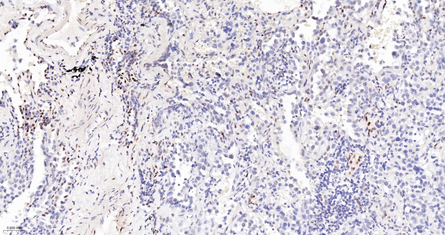 phospho-STAT3 (Tyr705) Mouse mAb (一抗) - IHC-P,IHC-F,IF | Bioss