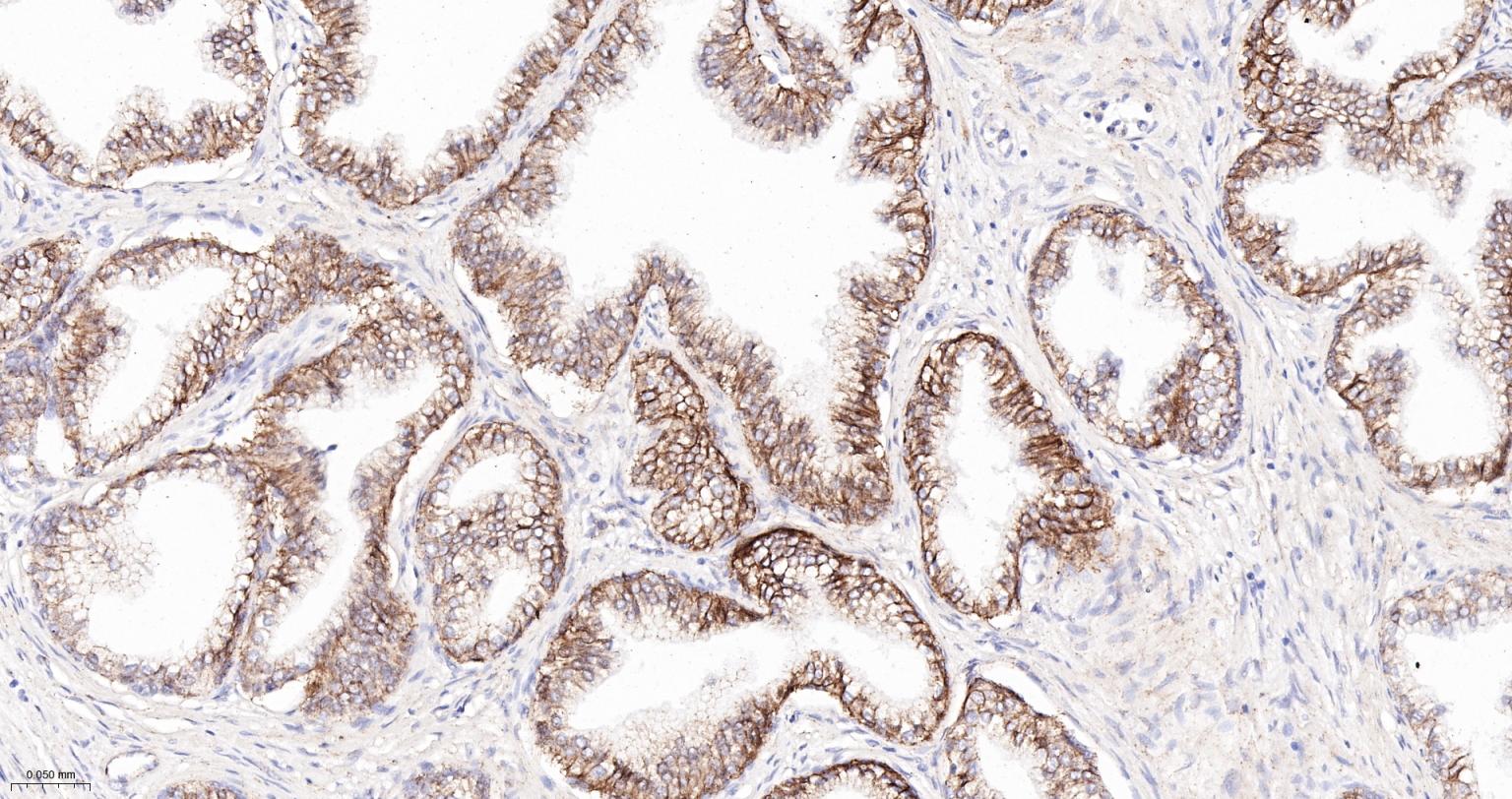 连环蛋白delta-1重组兔单抗