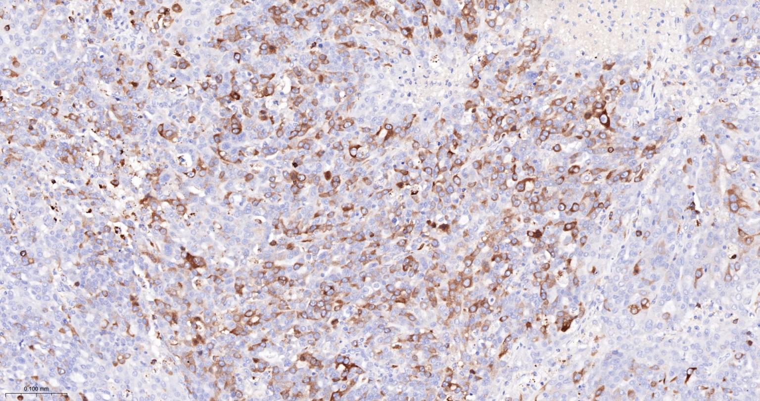 TACC3重组兔单抗