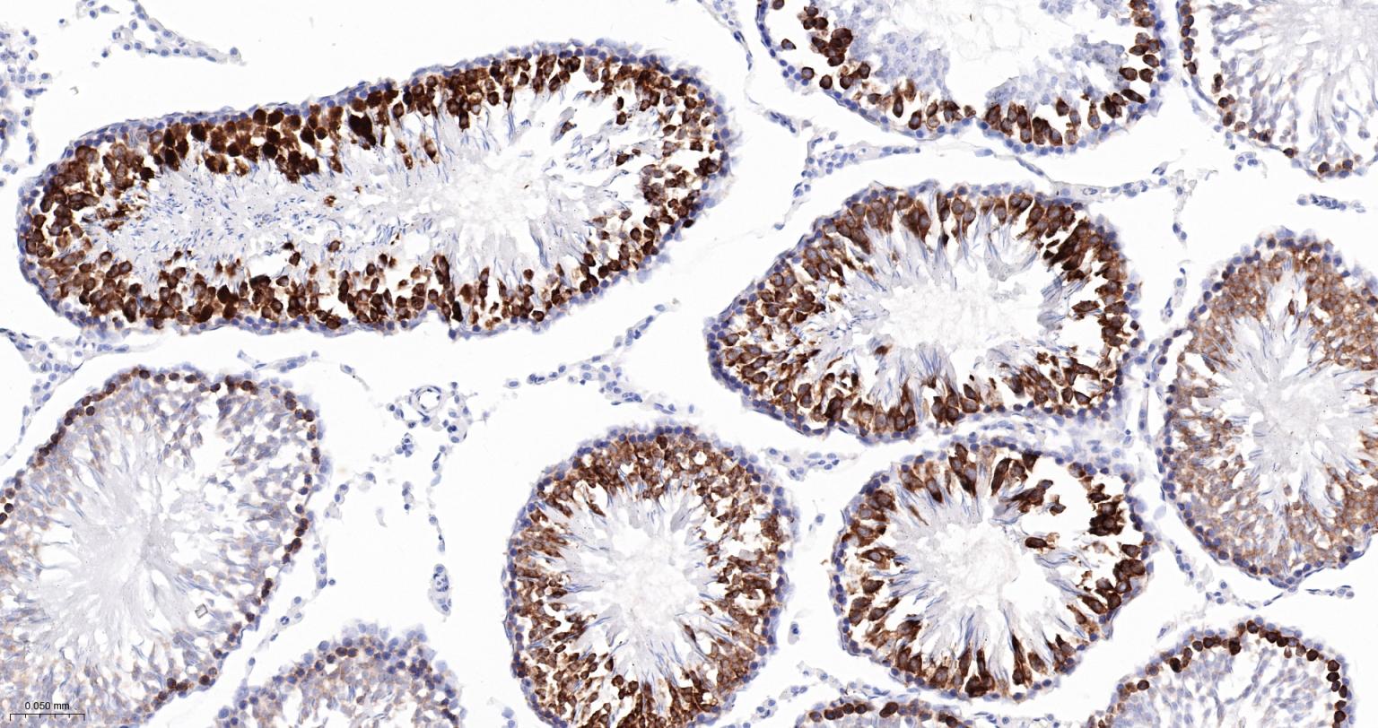 TACC3重组兔单抗