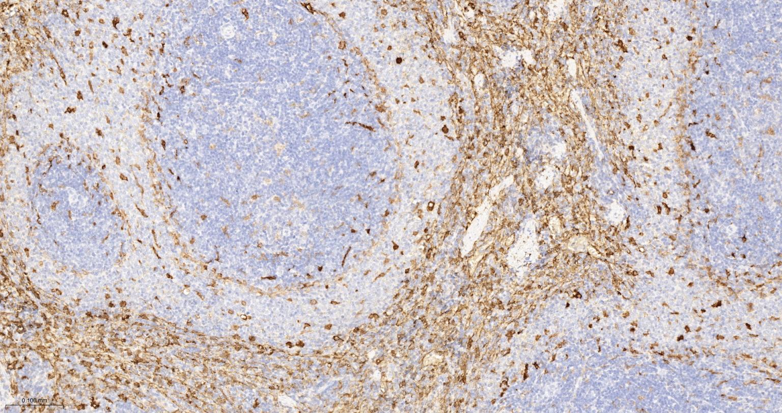 血红素氧合酶 1抗体