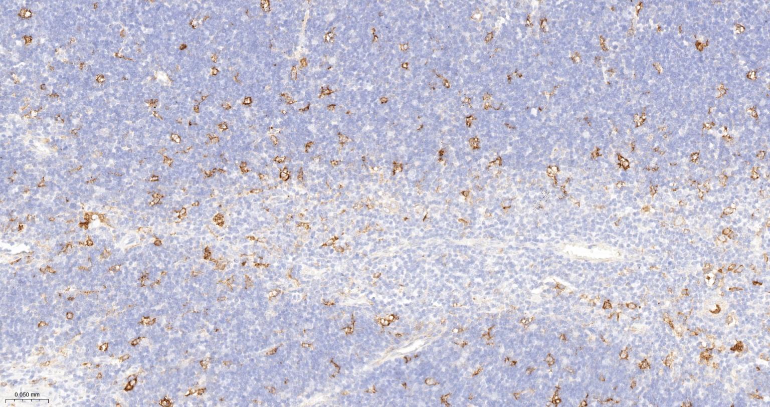 血红素氧合酶 1抗体