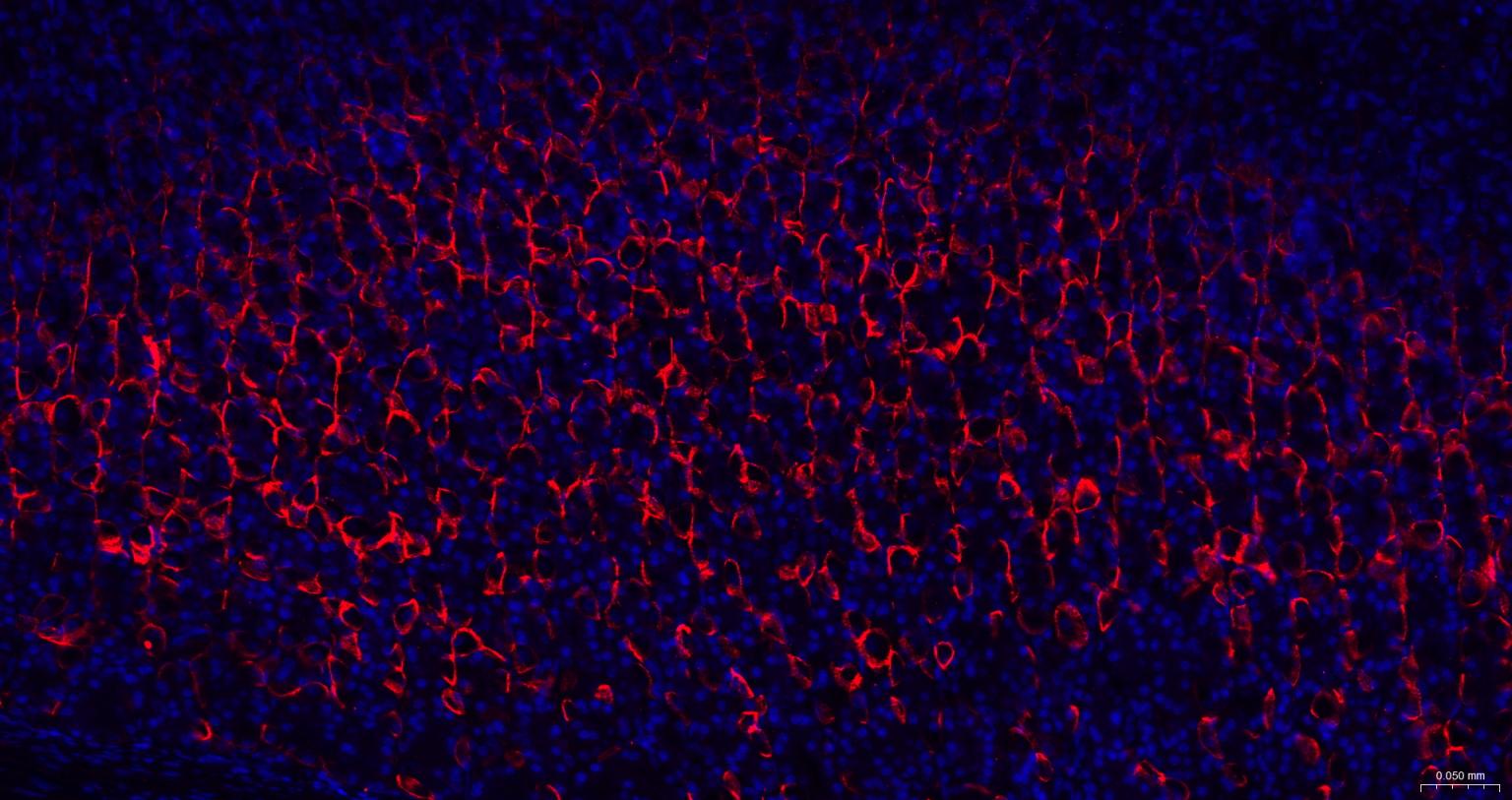 水通道蛋白4重组兔单抗