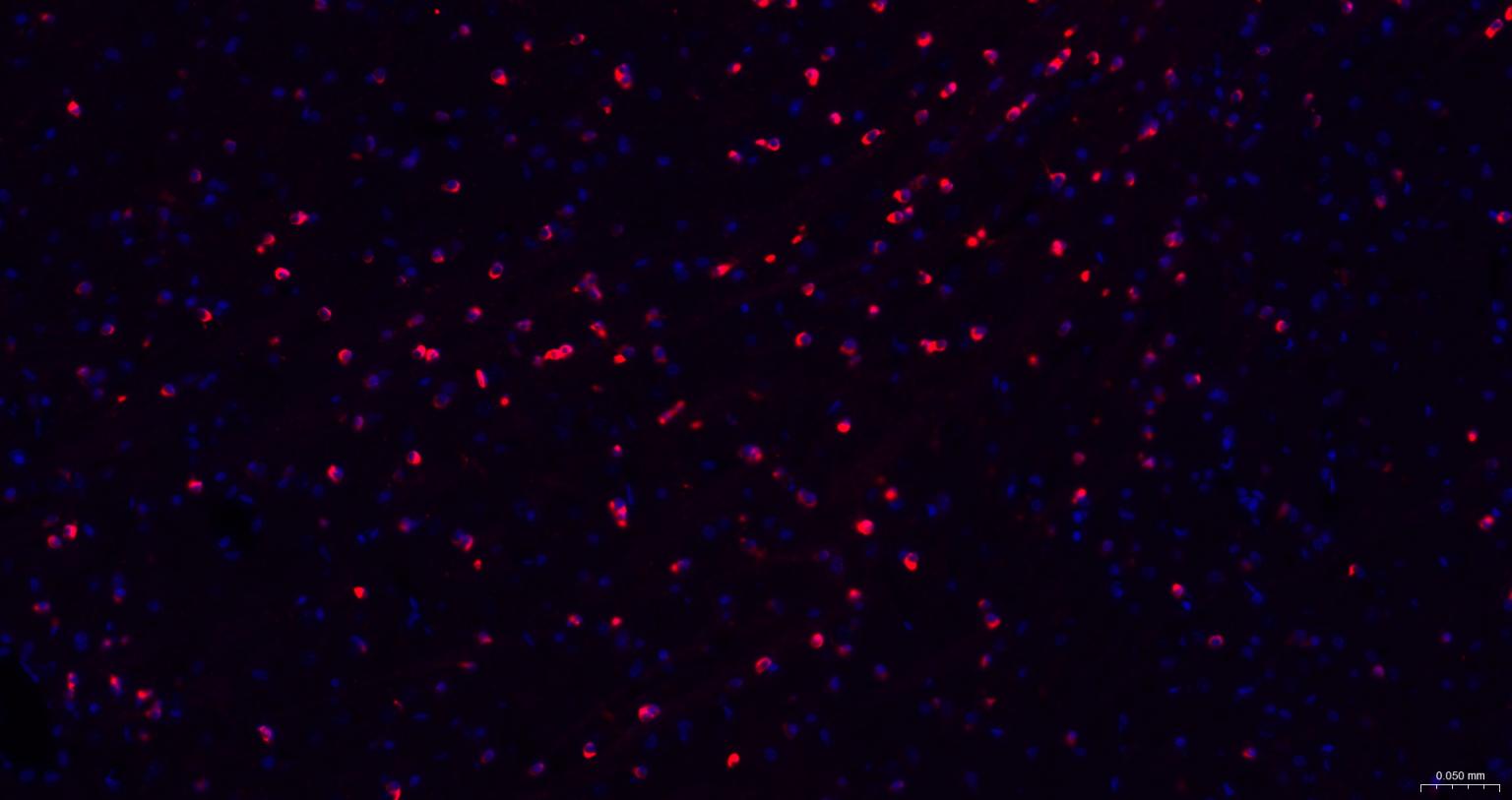 离子型谷氨酸受体1重组兔单抗