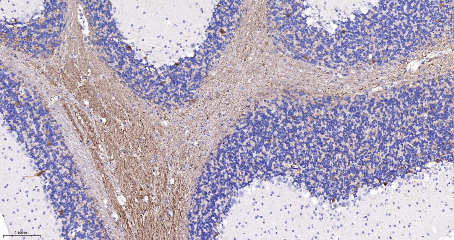 神经细胞胞浆蛋白9.5重组兔单抗