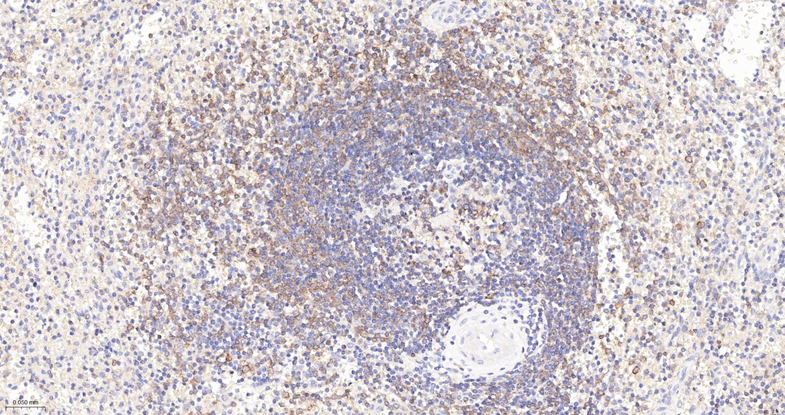 5-三磷酸肌醇受体1重组兔单抗