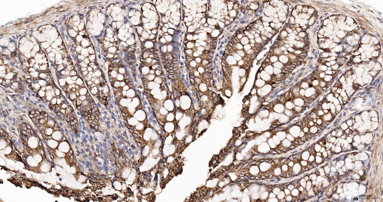 细胞角蛋白18抗体-bs-2043R