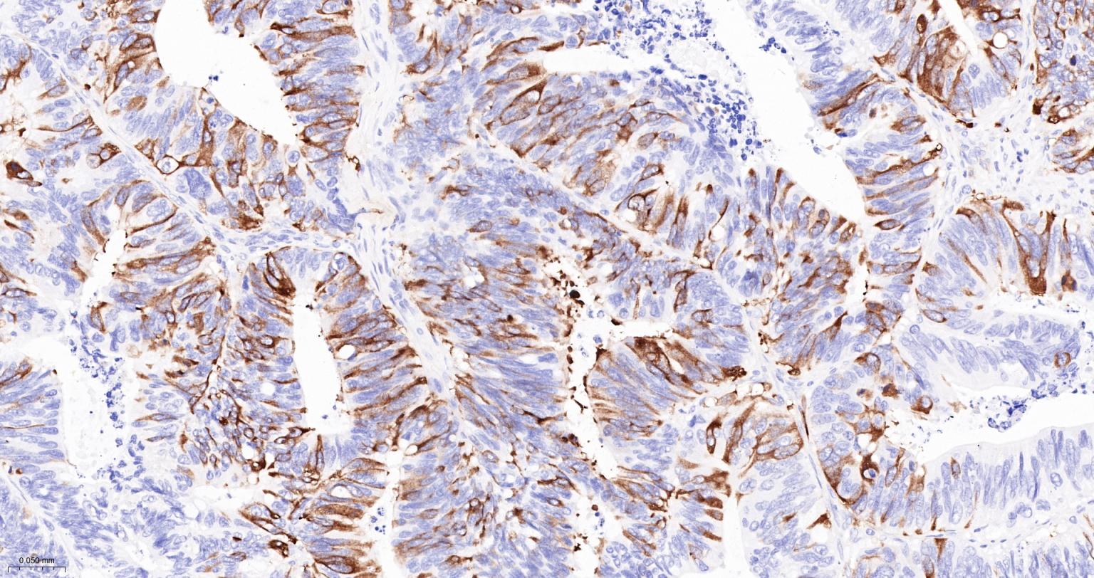TACC3重组兔单抗