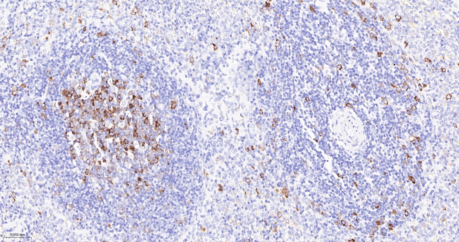 TACC3重组兔单抗