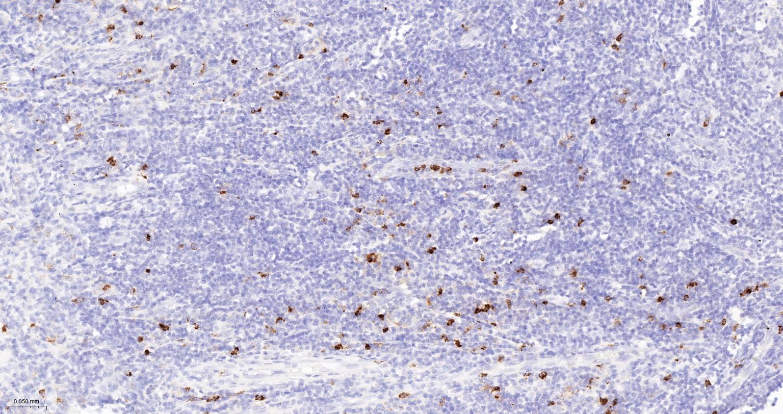 髓过氧化物酶重组兔单抗