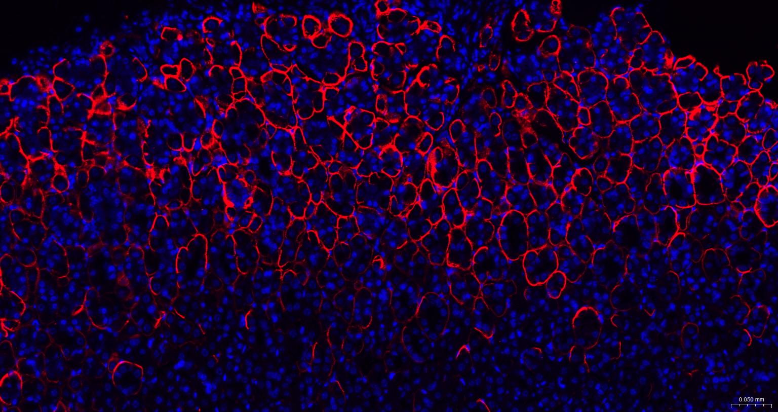 水通道蛋白4重组兔单抗