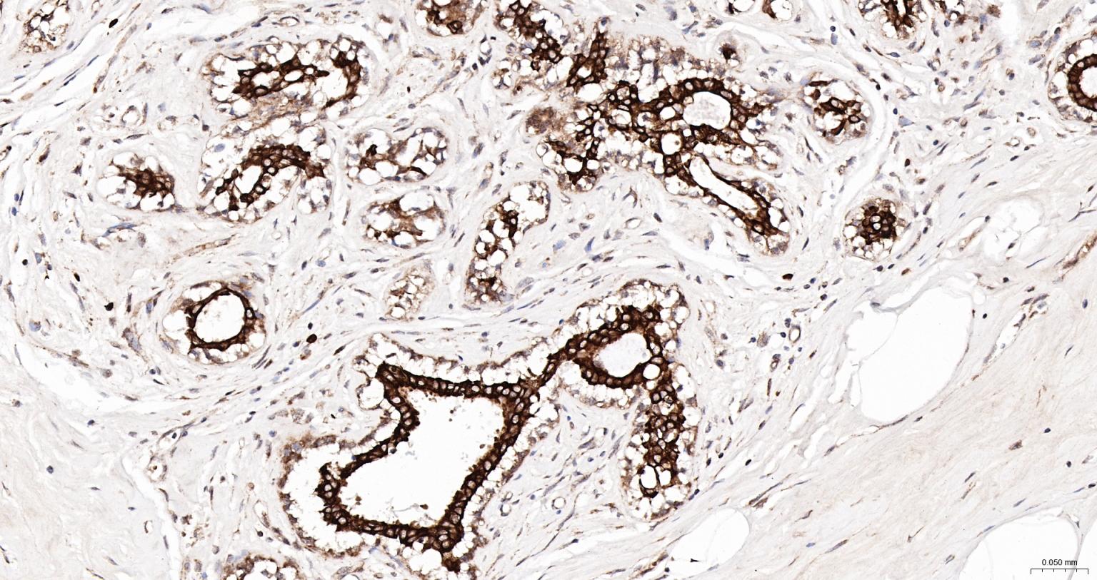 细胞角蛋白18抗体-bs-2043R