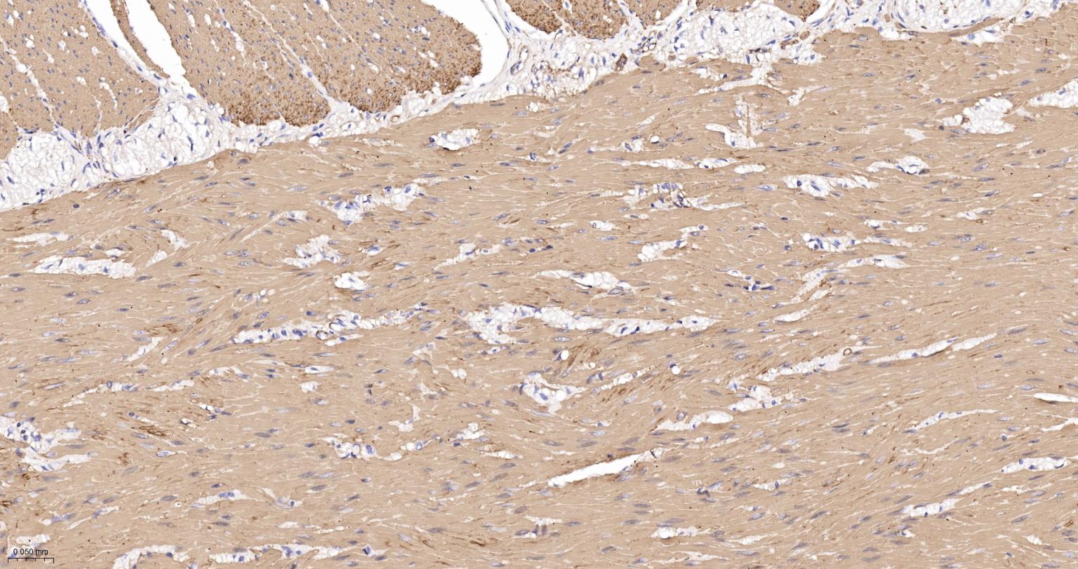 肌动蛋白α/α-SMA/α Actin单克隆抗体-bsm-33187M